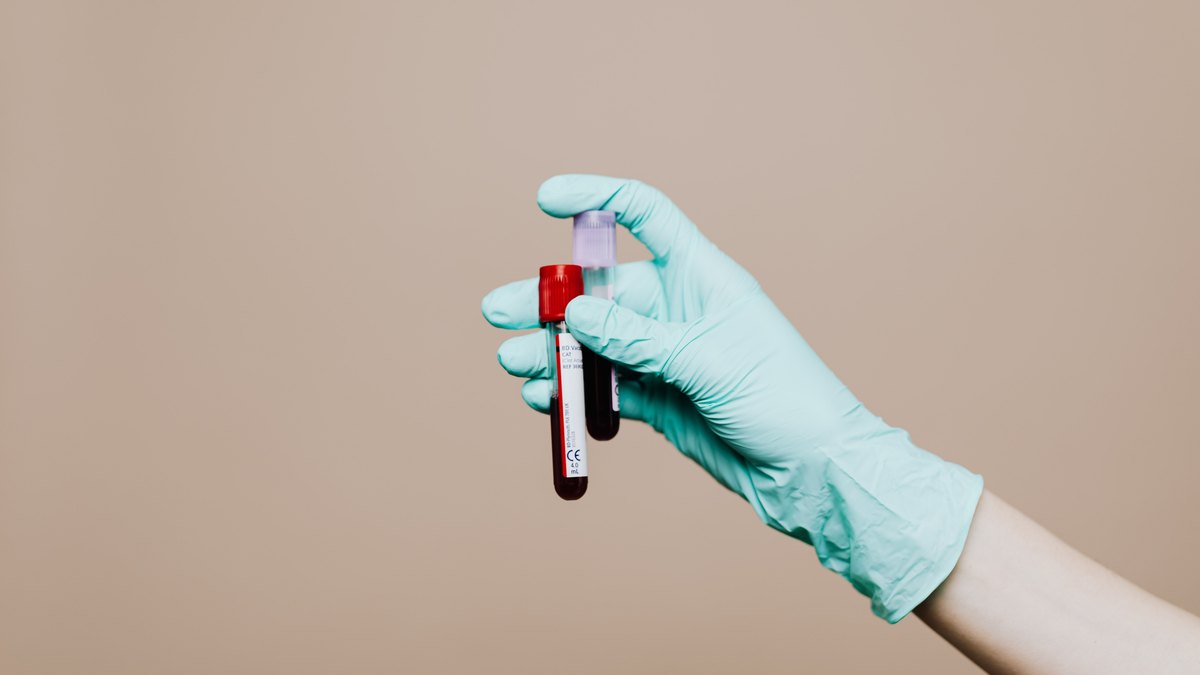 Иллюстрация к статье «analiz-na-vitamin-b12-norma»